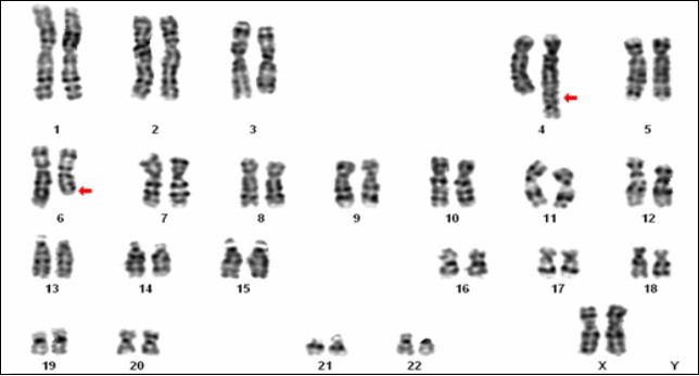Journal of family mediciene-Recurrent pregnancy loss