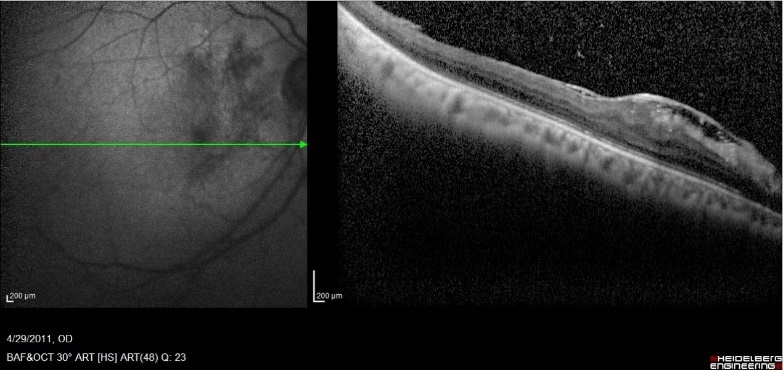 Journal of Ophthalmic Science-SD-OCT