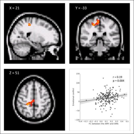 International Journal of Psychotherapy Practice and Research-Resting state