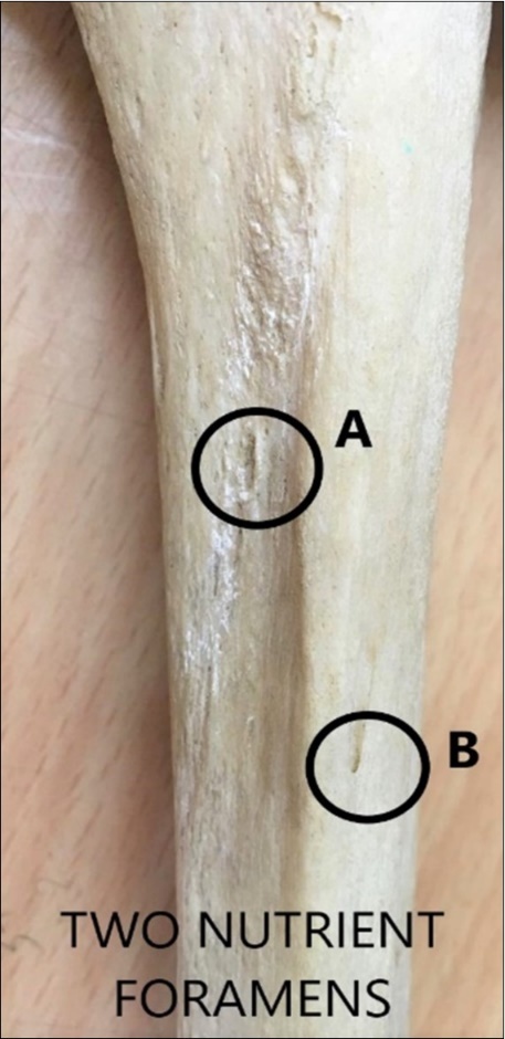 International Journal of Human Anatomy-Tibia