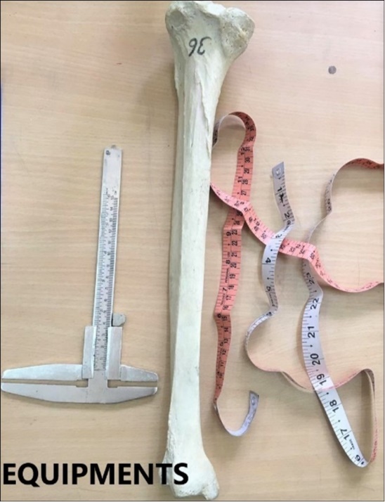 International Journal of Human Anatomy-Tibia