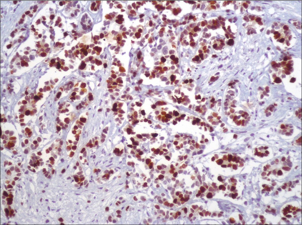 Journal of Clinical Case reports and Images-Acute