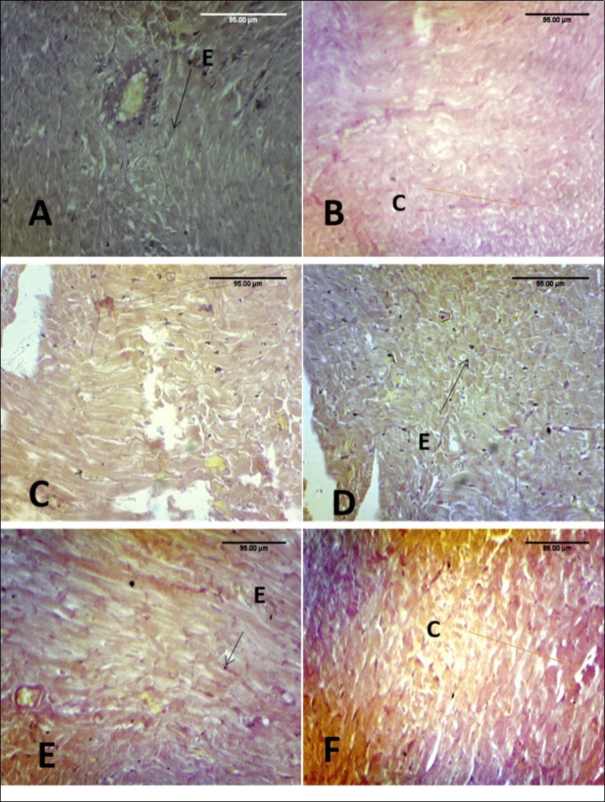 International Journal of Human Anatomy-Paraquat