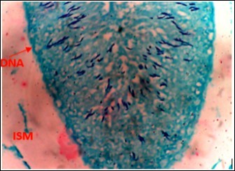 International Journal of Nutrition-Auriculariapolytricha