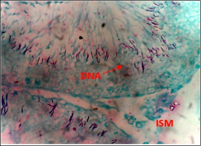 International Journal of Nutrition-Auriculariapolytricha