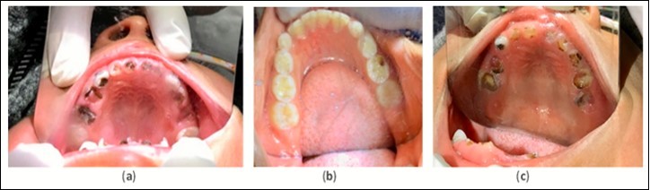 Journal of Public Health International-case report