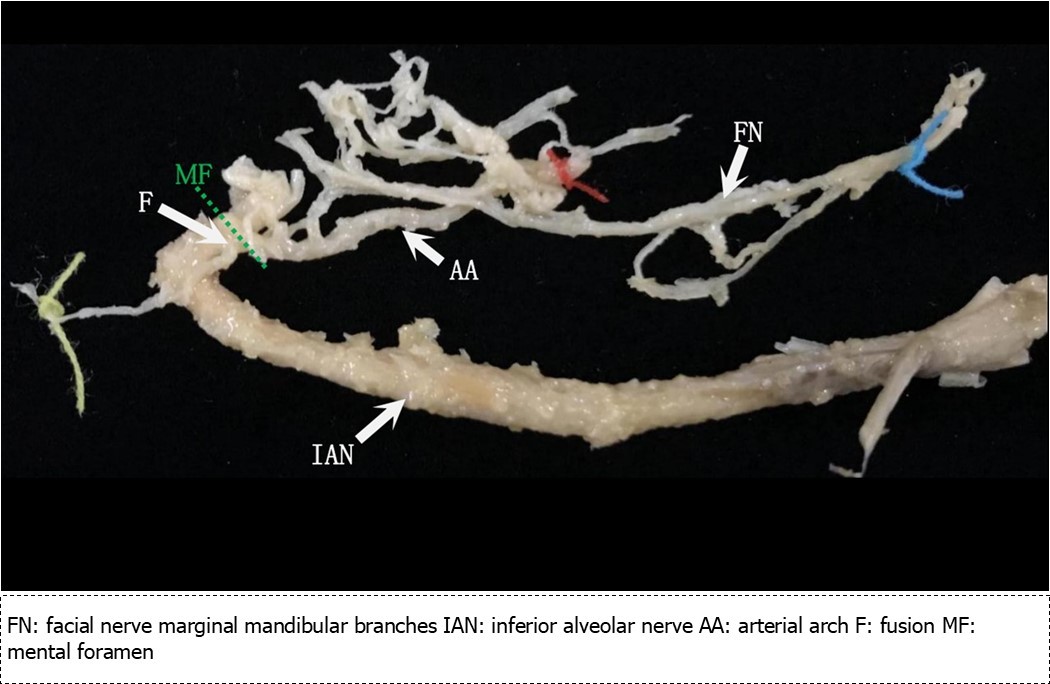 International Journal of Human Anatomy-mental nerve