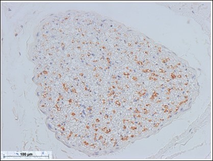 International Journal of Human Anatomy-mental nerve