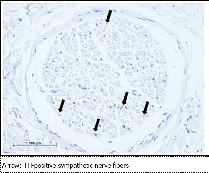 International Journal of Human Anatomy-mental nerve
