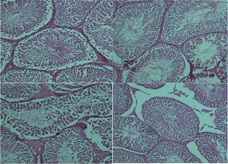 Journal of Antioxidant Activity-Oxidative stress
