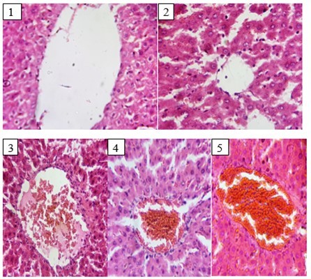 International Journal of Lipids-Cholesterol