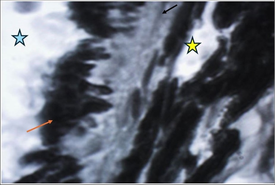 Journal of Aging Research and Healthcare - Berlin´s edema