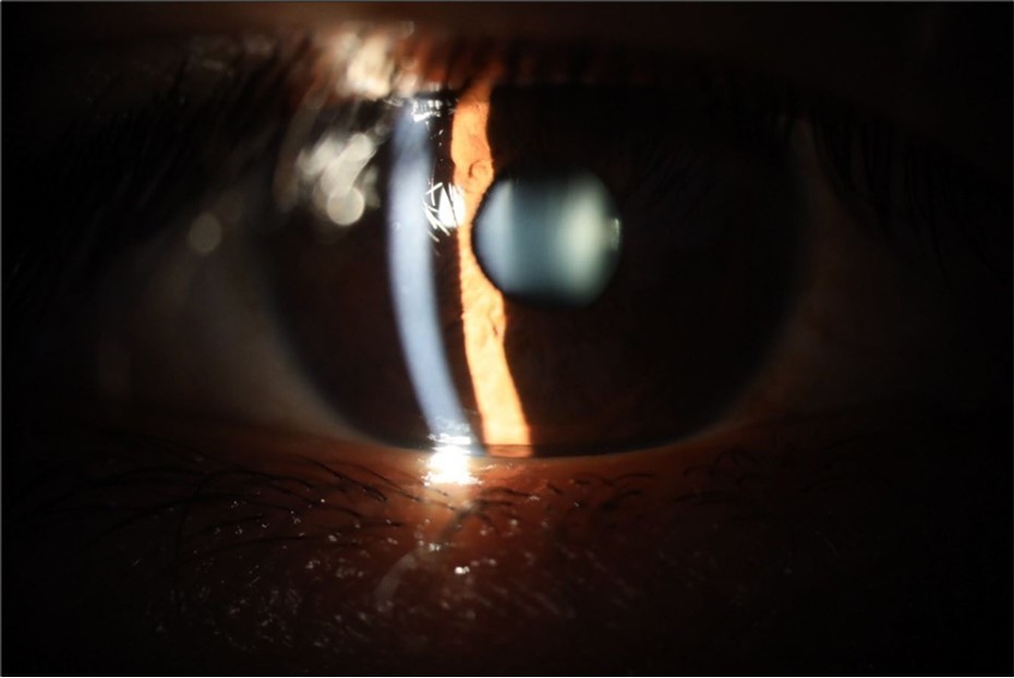 Journal of Aging Research and Healthcare - Berlin´s edema