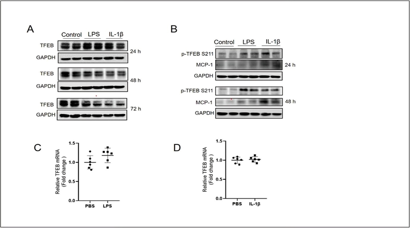 International Journal of Inflammation Research - Transcription Factor EB