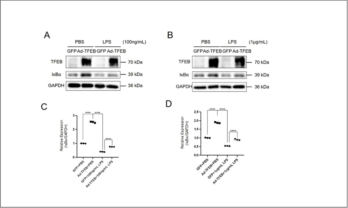 International Journal of Inflammation Research - Transcription Factor EB