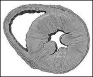 Journal of Hypertension and Cardiology-Heart Failure