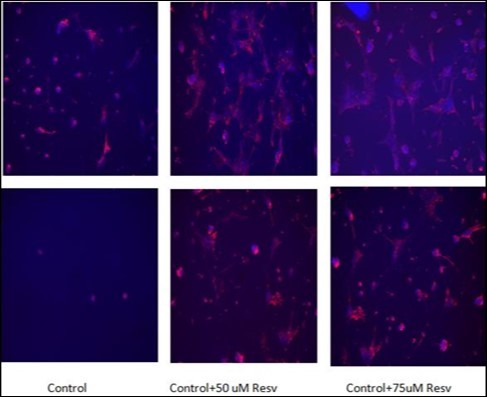 Journal of Behavior Therapy and Mental Health-Resveratrol