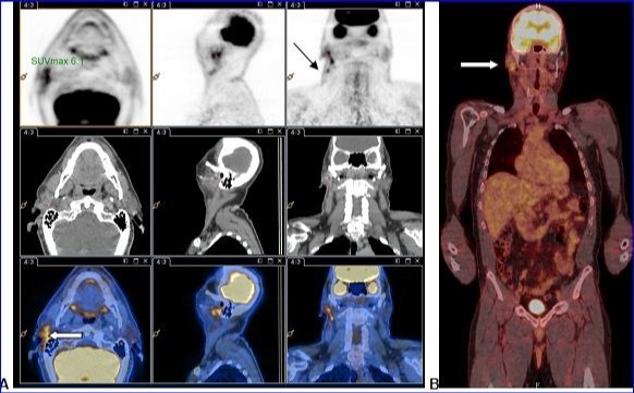 Journal Of Digestive Disorders And Diagnosis-parotid gland