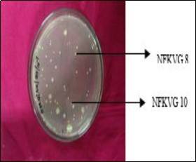 Journal of Biotechnology and Biomedical Science-Polyhydroxybutyrate
