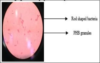 Journal of Biotechnology and Biomedical Science-Polyhydroxybutyrate