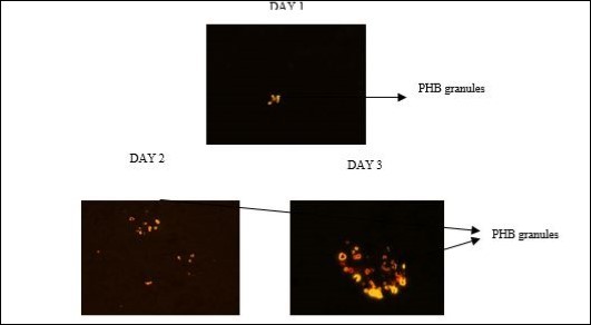 Journal of Biotechnology and Biomedical Science-Polyhydroxybutyrate
