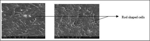 Journal of Biotechnology and Biomedical Science-Polyhydroxybutyrate