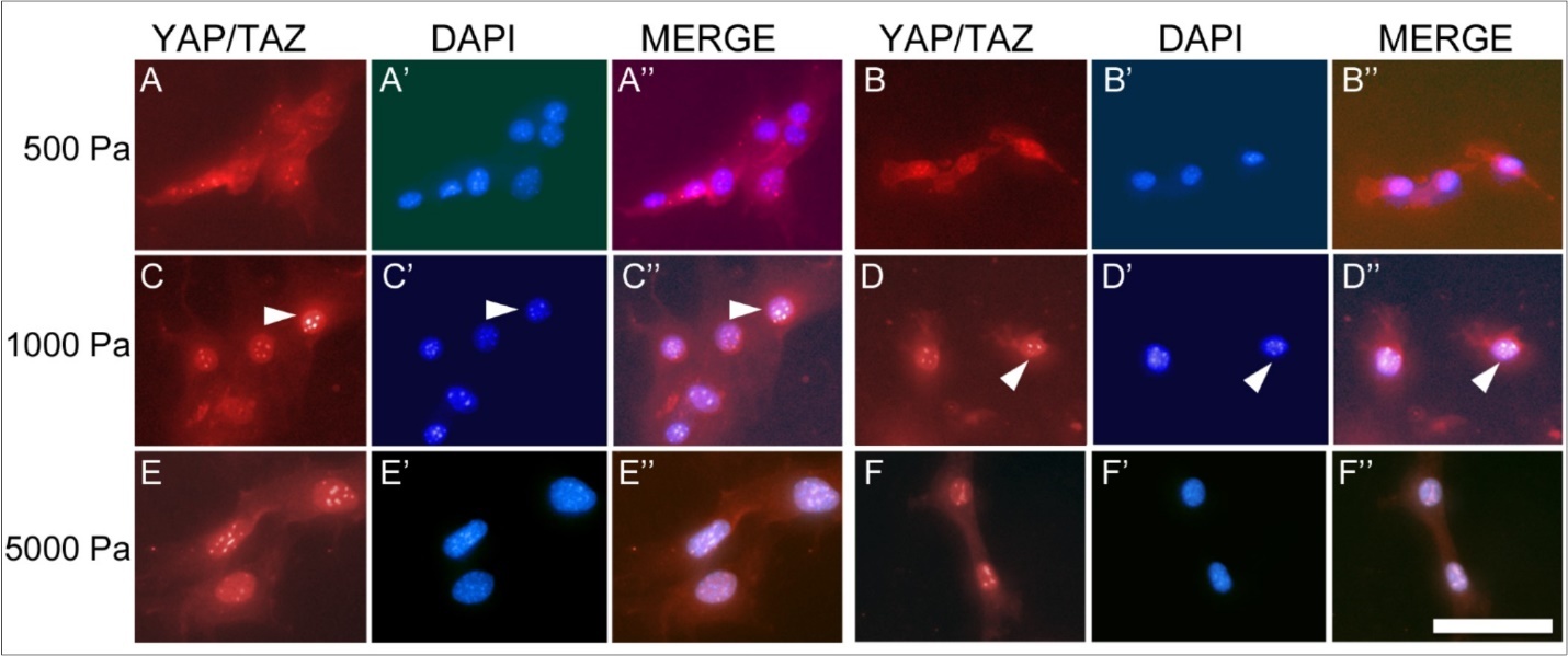 International Physiology Journal-Connective Tissue Growth Factor