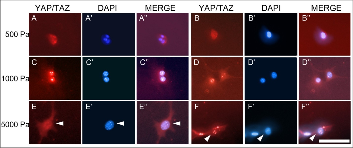 International Physiology Journal-Connective Tissue Growth Factor