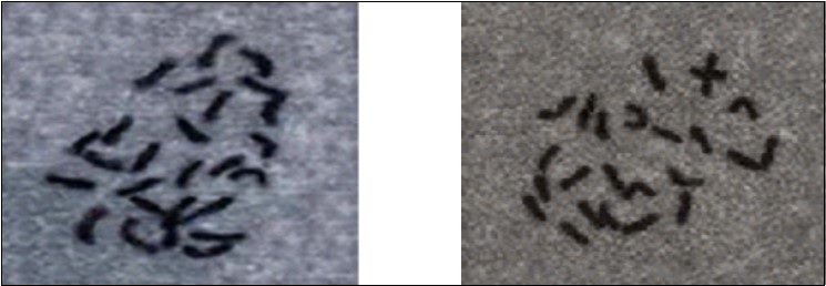 Cells of cocoyam accessions of the Xanthosoma genus in mitotic metaphase (100X): A) 2n = 26 chromosomes. B) 2n = 24 chromosomes.