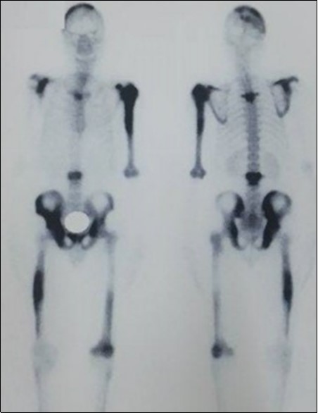 Journal of Spleen And Liver Research-Cholangitis
