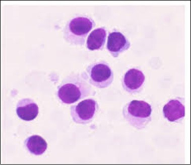 Journal of Clinical and Diagnostic Pathology-Leukaemia