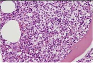 Journal of Clinical and Diagnostic Pathology-Leukaemia