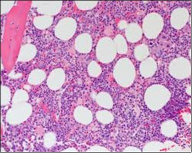 Journal of Clinical and Diagnostic Pathology-Leukaemia