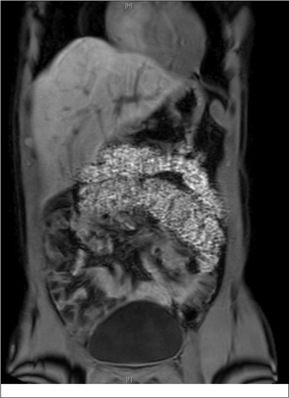 Keyhole Surgery Proceedings
