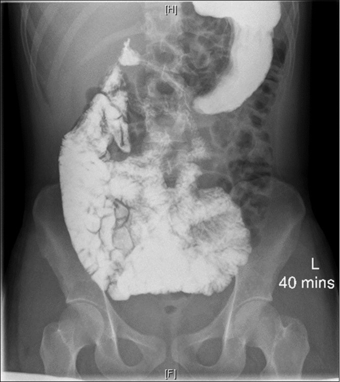 Keyhole Surgery Proceedings