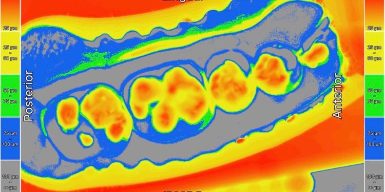 Article: Occlusal Contact Prints; A Biometric Means for Identification