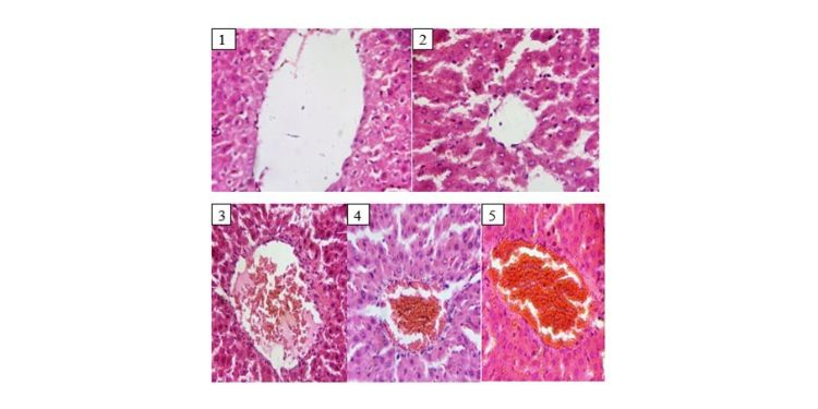 Article: Effect of Extracts of Dialium guineense Stem Bark on Lipid Profile and CCl4- Induced Histological Changes in Liver of Wistar Rats  
