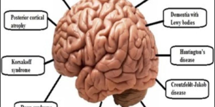 Article: Early Prediction of Alzheimer’s Disease Using OCT Imaging Technique