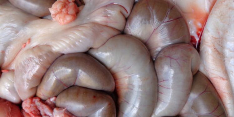 Article: Conclusion from the Doctor's Dissertation Martynov V.L. on Surgical Correction of Digestive              System Refluxes