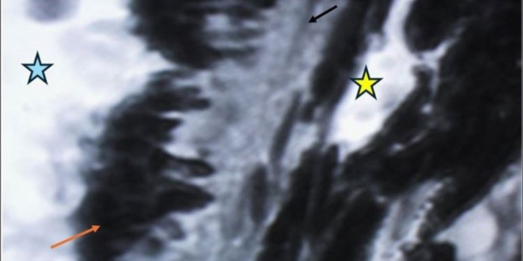 Article: Traumatic Maculopathy (Berlin´S Edema) Treated with Enhancement of Human Photosynthesis®