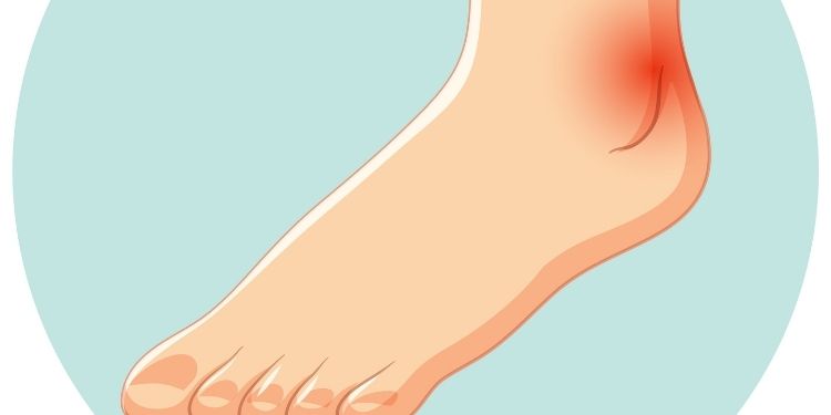 Article: Diabetic Foot and Leg Ulcer &amp; Peri-wound Neuropathy Healing Feasibility Studies